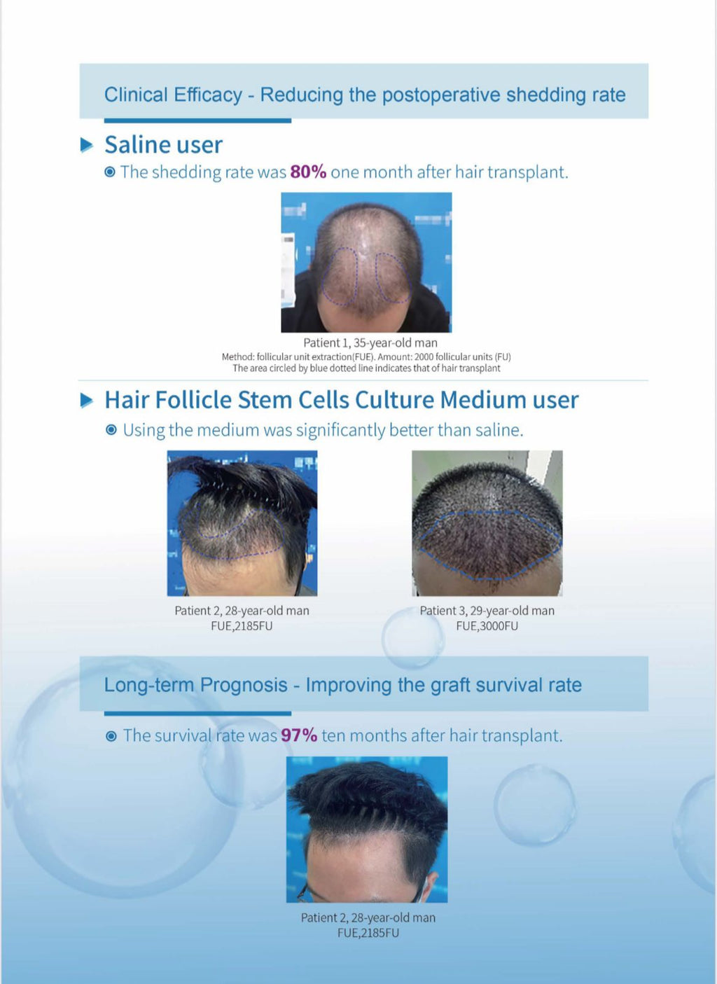 HAIR FOLLICAL STEMS CELL CULTURE