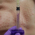 HYARON-SKIN BOOSTER |NON-CROSSLINKED HA,25MG/2.5ML