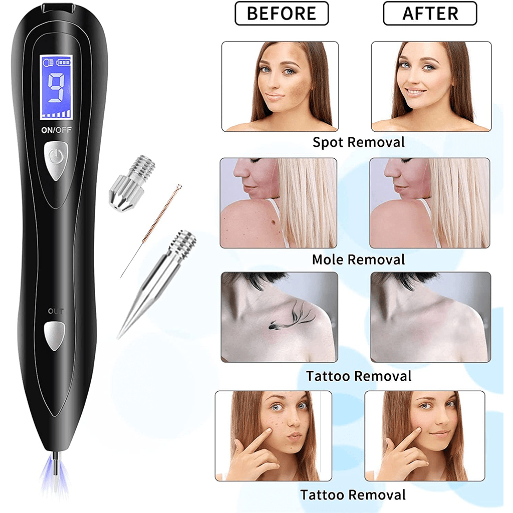 PLASMA PEN MOLE REMOVER
